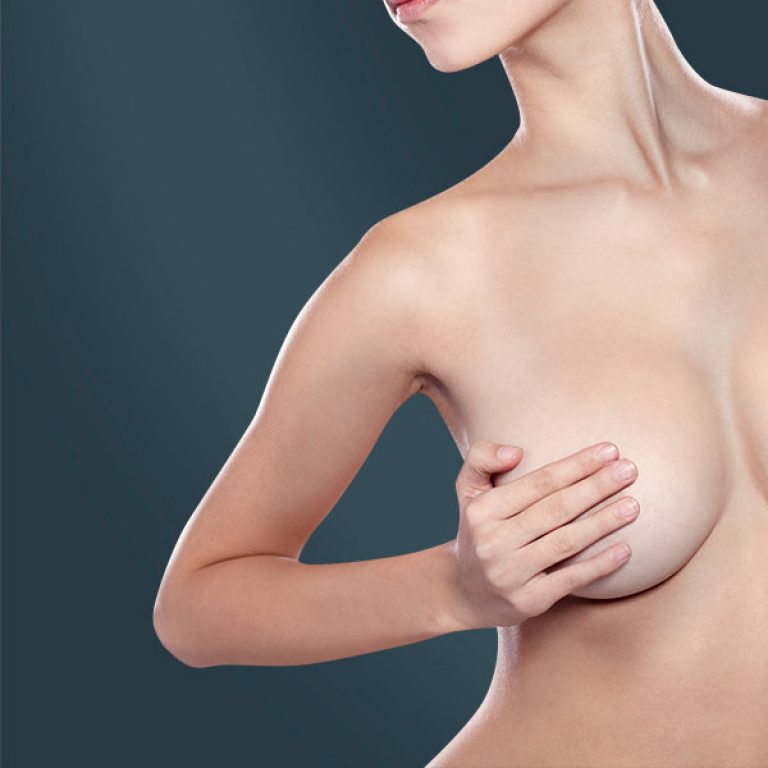 mamoplastia